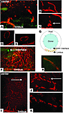 Initial (3–7 days) and late (56 days) phases of lymphangiogenesis after PKP