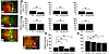 Comparison of hemangiogenesis and lymphangiogenesis after PKP. (A–C) Photom