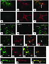 Lymphatic vascular endothelium after PKP and suture placement. (A–F) Fluore