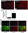 Effect of macrophage depletion on lymphangiogenesis after suture placement.