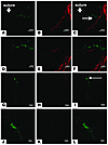 Involvement of EPCs in lymphatic vascular development following corneal sut