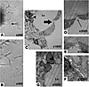 TEM image of a tube-like structure formed by CD11b+ PECs. (A and B) Three-d