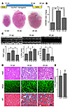 Extensive hypertrophy and contractile dysfunction induced by prolonged Akt