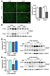 Coronary angiogenesis and angiogenic growth factor expression. (A) Left: Re