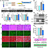 Inhibition of coronary angiogenesis results in impaired cardiac growth and