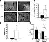 Absence of FHL2 enhances osteoclast resorptive activity and RANKL-stimulate