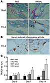 FHL2 is expressed only in activated osteoclasts. (A) WT mice were administe