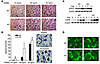 Absence of FHL2 accelerates osteoclast differentiation and cytoskeletal org