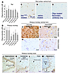 Distribution of antisense oligonucleotides after infusion into the right la