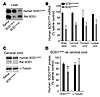 Antisense oligonucleotides complementary to humanSOD1