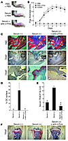 Anti–c-Fms mAb blocks inflammatory arthritis–induced osteoclastogenesis and