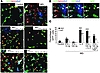 High-dose IFN-γ, by inducing TNF-α, inhibits the ability of MG to support o