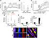 In mice with chronic EAE, intraventricularly injected MG(IL-4)