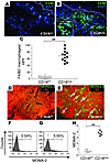 Increase in macrophages numbers in lesional skin and ski