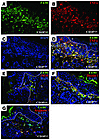 Activated macrophages are an important source of TNF-α i