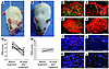 Improvement of the psoriasiform phenotype of affectedCD1