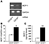 Enhanced MCP-1 mRNA and protein level