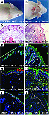 The injection of a combination of rJE/MCP-1 and rTNF-α i