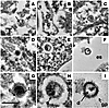 Thin section EM of NOD/SCID-hu spleens demonstrated virion production 3 mon