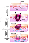 Role of barrier acquisition in the epidermal response to wound healing.