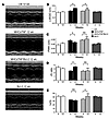 Effect of Bcl-2 on LV remodeling.