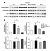 Myocardial levels of proapoptotic proteins.