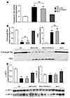 Myocardial caspase-8 activation, Bid, and IAPs.