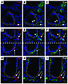 PSCs are CD44+ stromal cells.