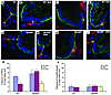 PSCs were closest to the crypt base epithelium in WT DSS-injured mice.