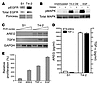 Upregulation of an autocrine growth factor loop during a model of breast ca