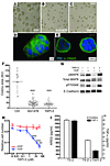 Inhibition of sheddase activity reverts the malignant phenotype of T4-2 cel