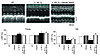 Echocardiographic measurements of LVEF.