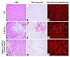 Histological examples of the necrosis and fibrosis in old WT (A–C), old β2-