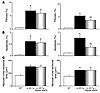 Fibrosis, apoptosis, and myocyte cross-sectional area in old WT, β1-AR Tg,