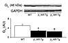 Giα was decreased in both old β1-AR Tg and old β2-AR Tg mice compared with