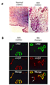 AIA and human RA exhibit αvβ3 expression on angiogenic blood vessels. (a) C