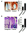 Blockade of integrin αvβ3 decreases pannus formation and cartilage erosions