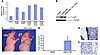 Akt causes vertical growth melanoma in vivo.