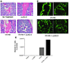 Visualization of clone 4 cells within prostates and tumor growth inhibition