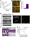 Premature cellular senescence and aging-like features in Ews–/– mice.