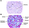 Image analysis of a prostate tissue sample.