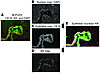 Spectral image segmentation for quantifying nuclear AR in control prostate