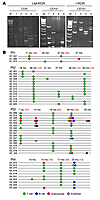 Vector clonal composition in distinct hematopoietic lineages after GT.