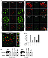 RHPS4 triggers DNA damage response at telomeres.