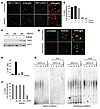 RHPS4 specifically and rapidly delocalizes POT1 from telomeres.