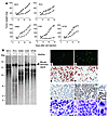 RHPS4 is active as single agent in xenograft tumors by inducing telomere in