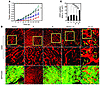 Tumor growth rates and vasculature.