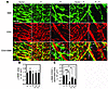 Interaction between VSMCs and ECs in tumors.