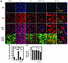 Interaction between pericytes and ECs in tumors.