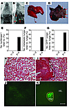 Stimulation of metastasis by coexpression of FGF2 and PDGF-BB in tumors.